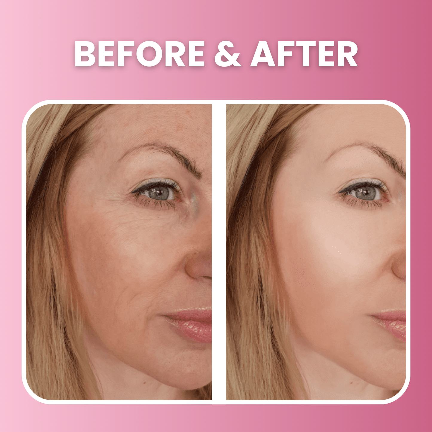 Anti-Wrinkle Face Massager